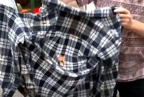 Klokan brutálne napadol svojich ošetrovateľov