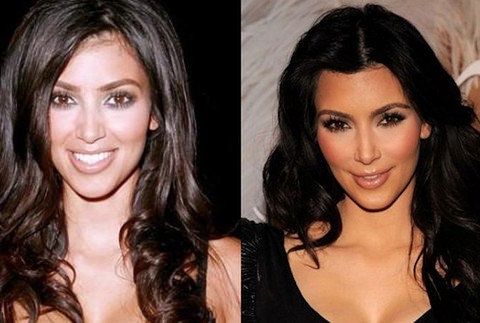 Kardashianky a ich rodina Kim Kardashian - plastiky 3