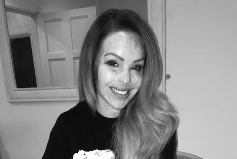 katie piper