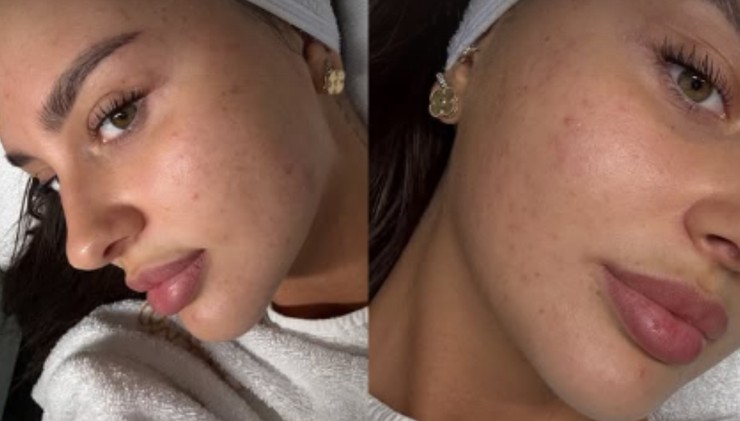 Separ, Teri Pallová (1)