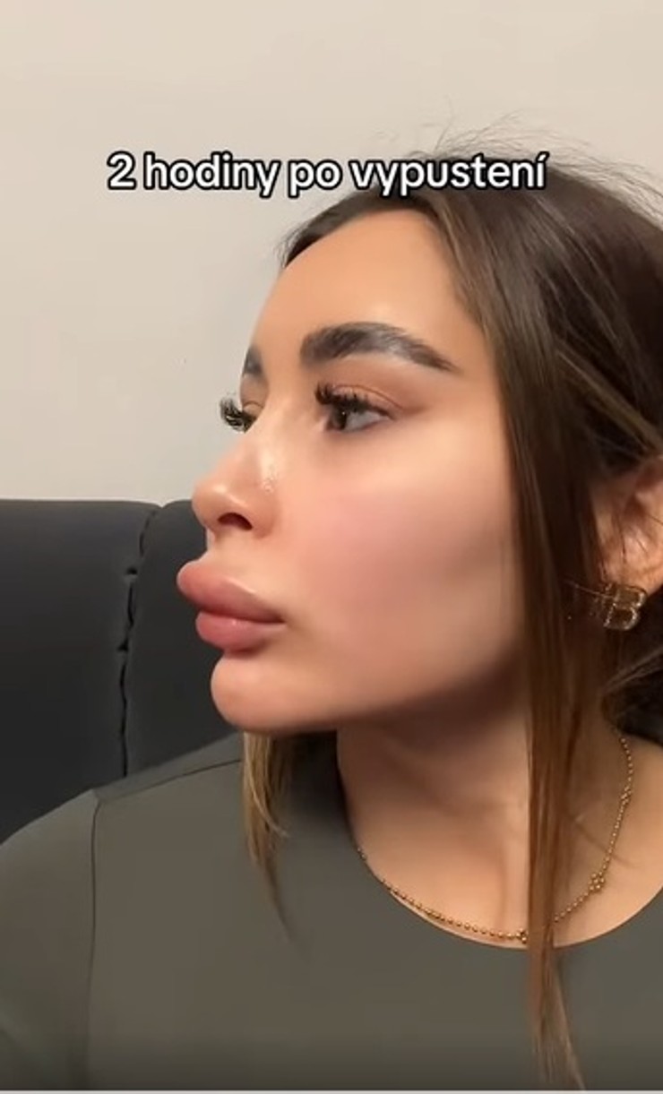 Karolína Shawty