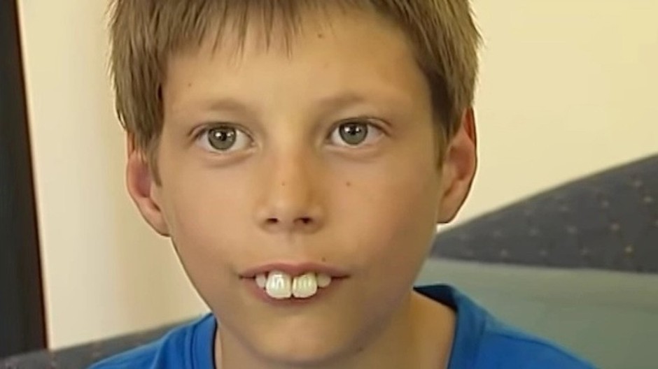 veľké zuby