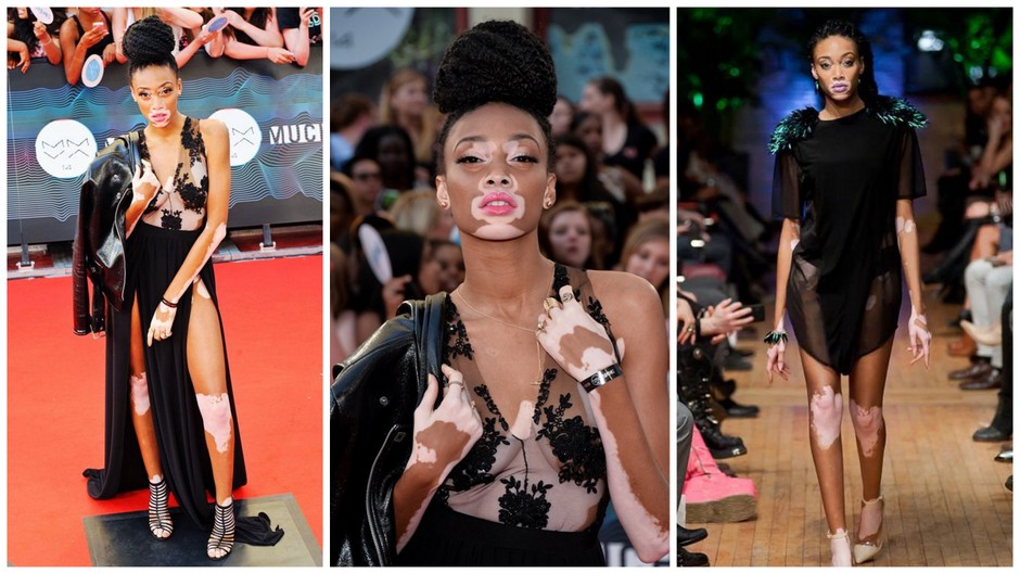 Winnie Harlow hlavna