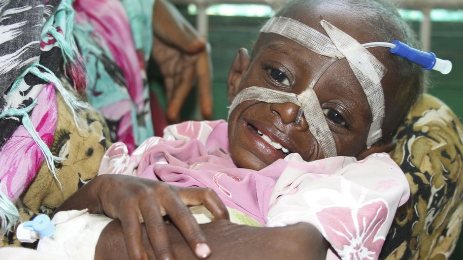 Sucho a hlad zabíjajú deti v Somálsku, potravinová kríza, Afrika