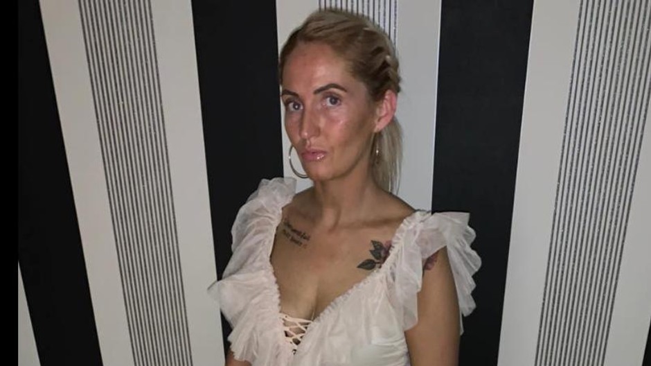nevydarena aplikacia samoopalovacieho kremu