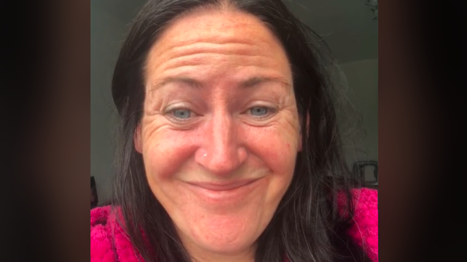 zena a botox