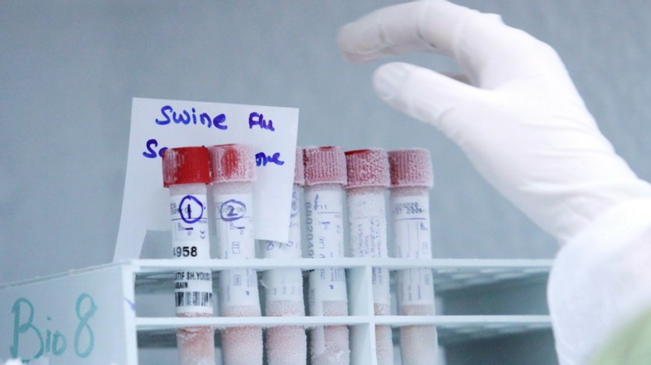 laborant kontroluje vzorky testované na prasaciu chrípku