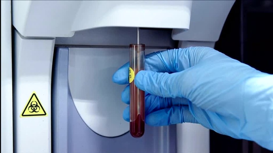 Antidopingoví komisári najviac kontrolovali Sagana a Kuzminovú. Pridali sa ale aj ďalšie mená301