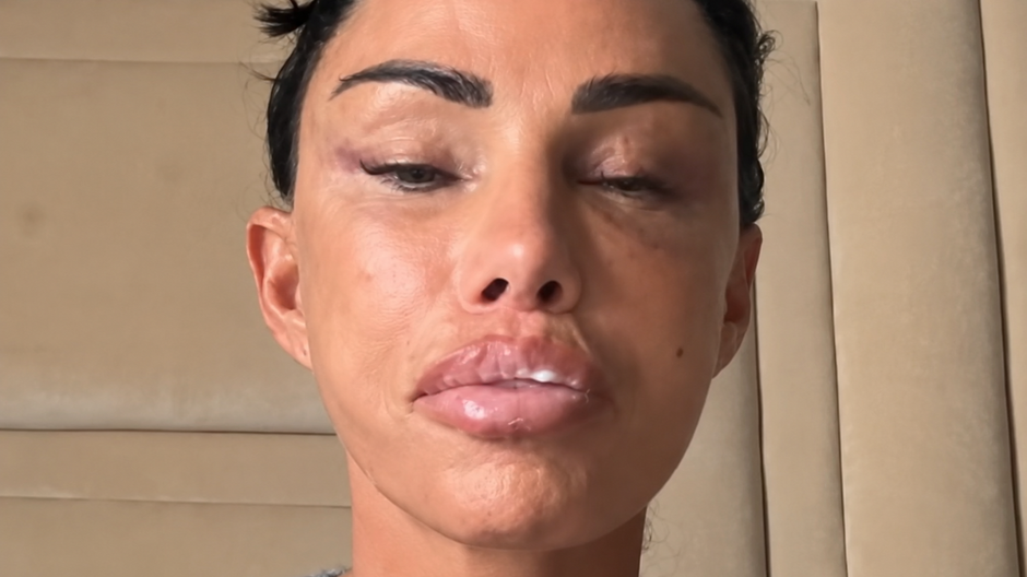 Katie Price