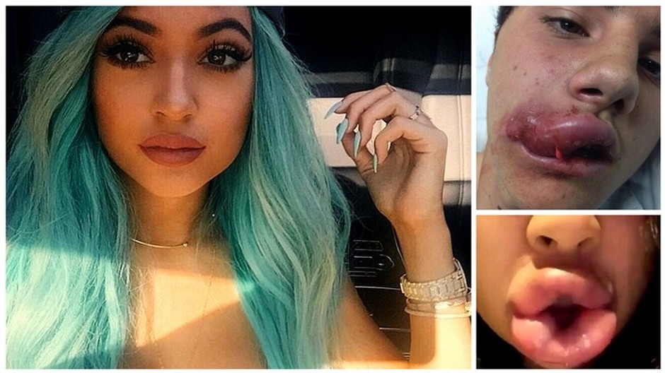 kylie
