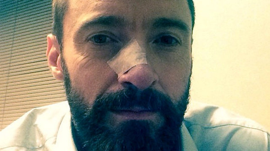 Hugh Jackman