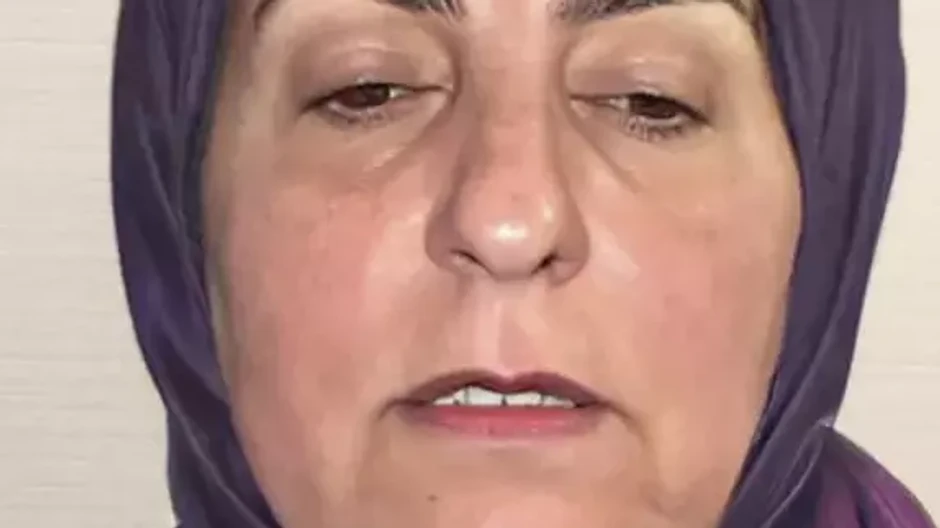 žena pred plastikou