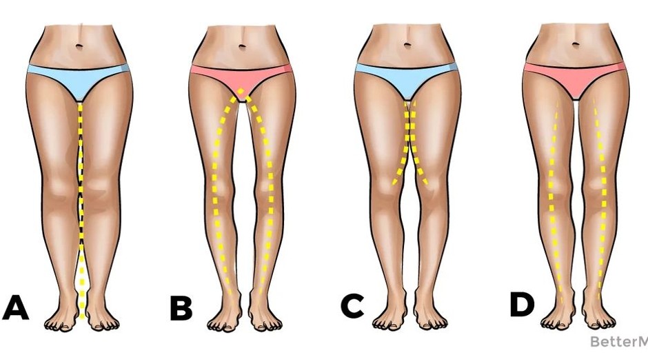 typy ženských nôh