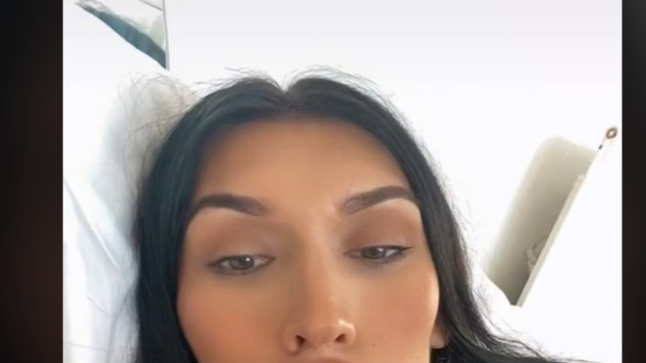 nevydarene plastiky