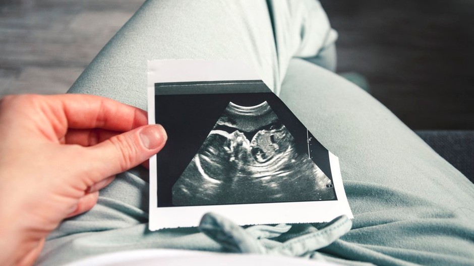 sono, tehotna, ultrazvuk