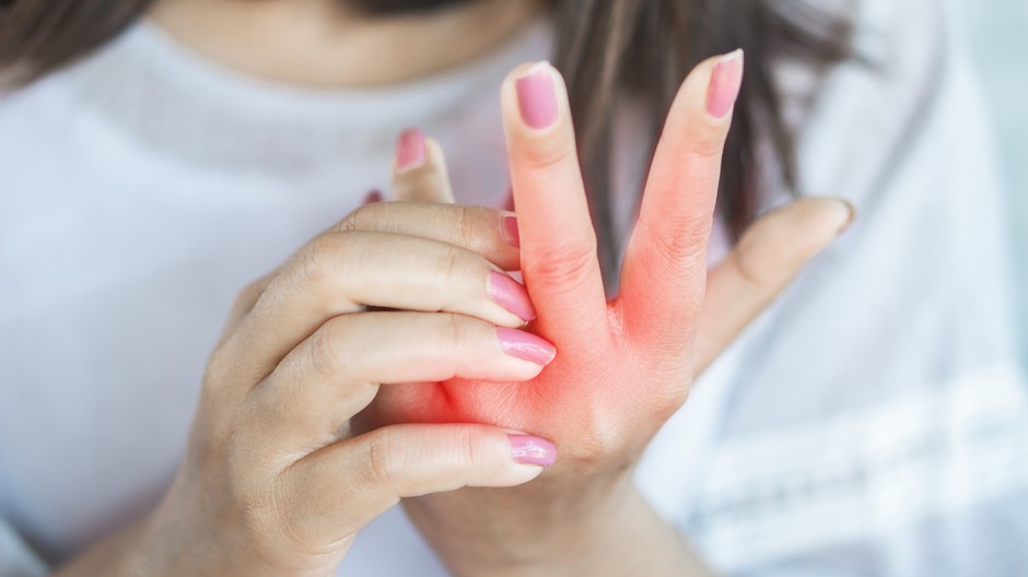 Sklerodermia pr správa