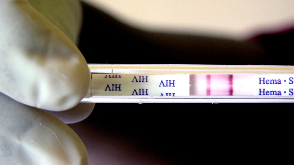 HIV test