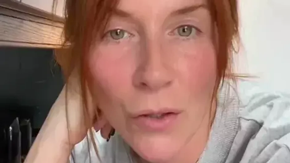 Kate, pleť