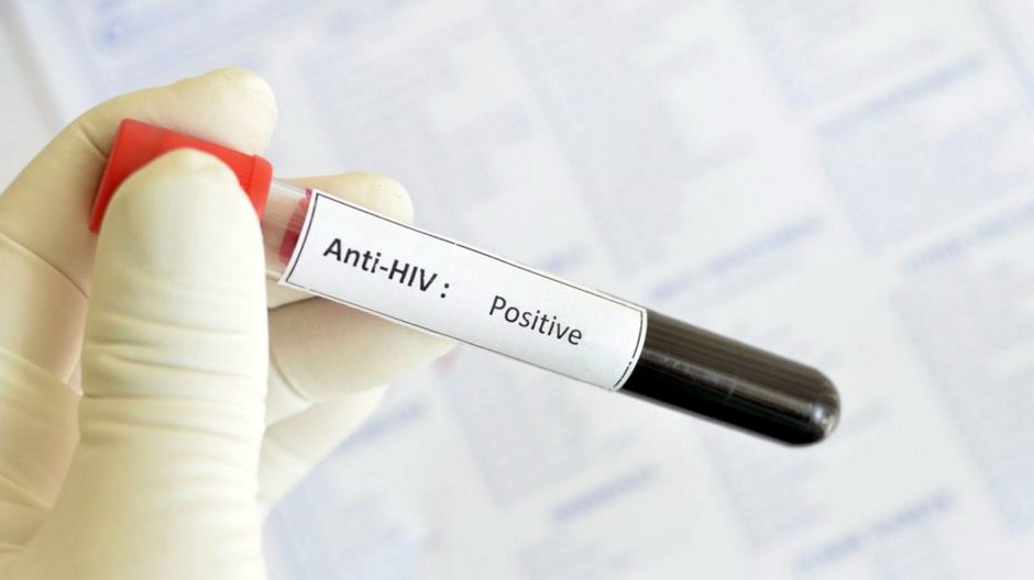 PR HIV positive