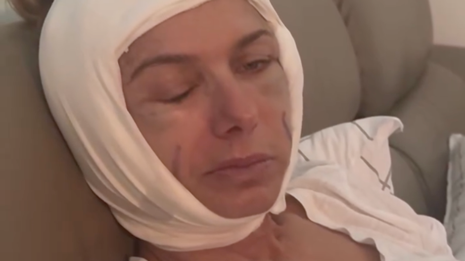 Alice Bendová po plastike