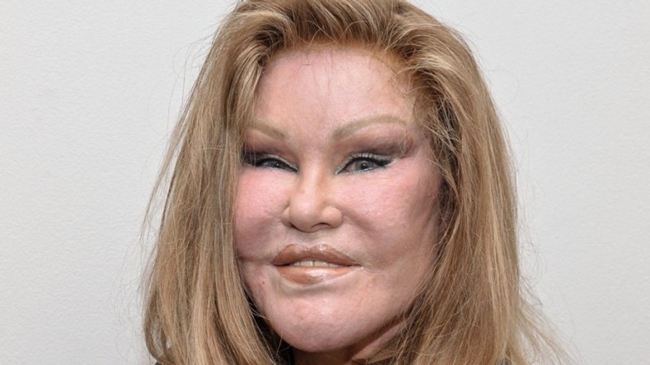 Jocelyn Wildenstein 