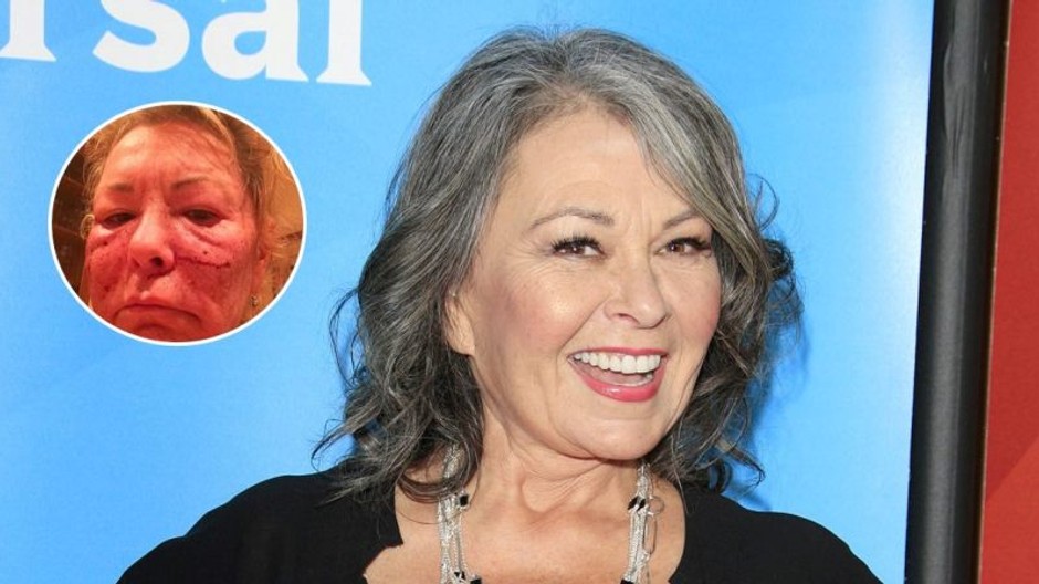 Roseanne Barr
