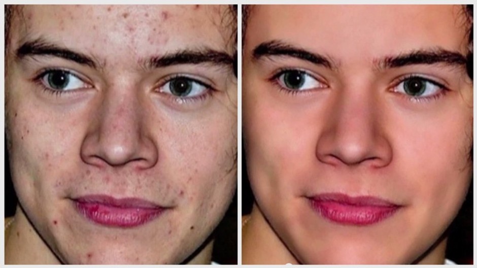 Harry Styles
