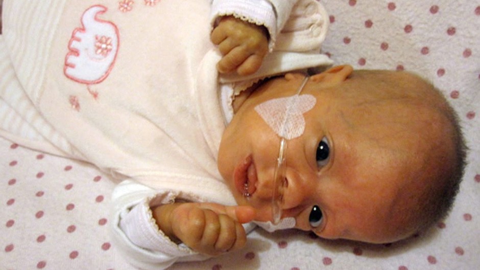 Dievčatko, ktoré sa pred časom narodilo s 280 gramami