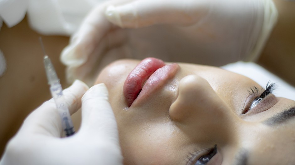 lip-filler-g878953bc9_1280