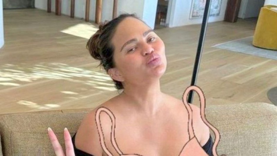 Chrissy Teigen