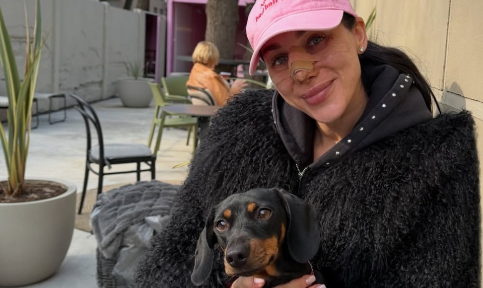 Najprv plastika nosa, teraz TOTO? Bianka Rumanová opäť šokuje fanúšikov!