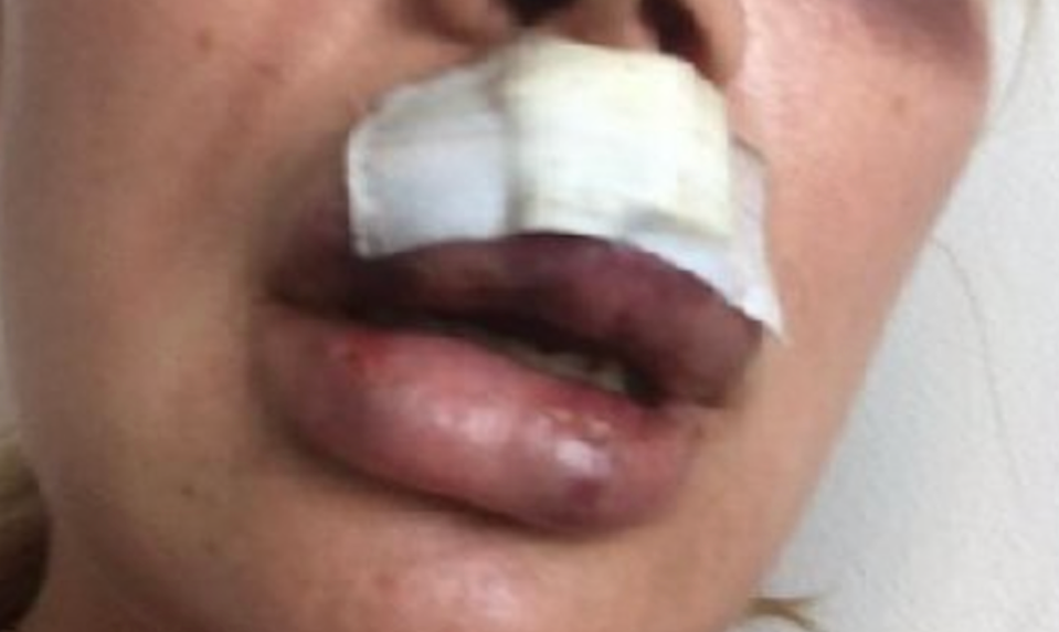 Nielen sexistické názory, ale aj násilnosti?! Známy český boháč údajne zbil expriateľku!